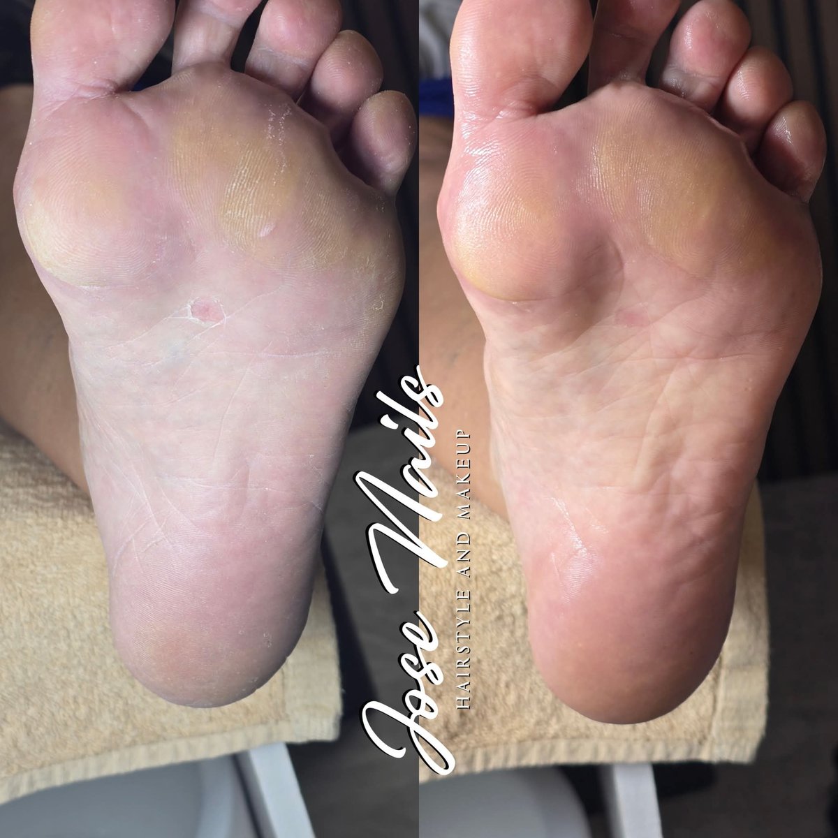 JESPADA's tweet photo. Antes y Después 
Seguimos cuidando esos pies con los productos de #Cuccio 
#josenailshairstyleandmakeup 
#pedicuraspa #pedicuras #Pedicuraclinica #pedicure #pies https://t.co/Y93aMs9A5N