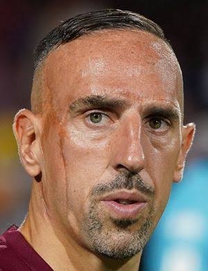 fontre20's tweet photo. What's the cause of the scar on the right side of Ribery's face? https://t.co/wUdKXPGz0m