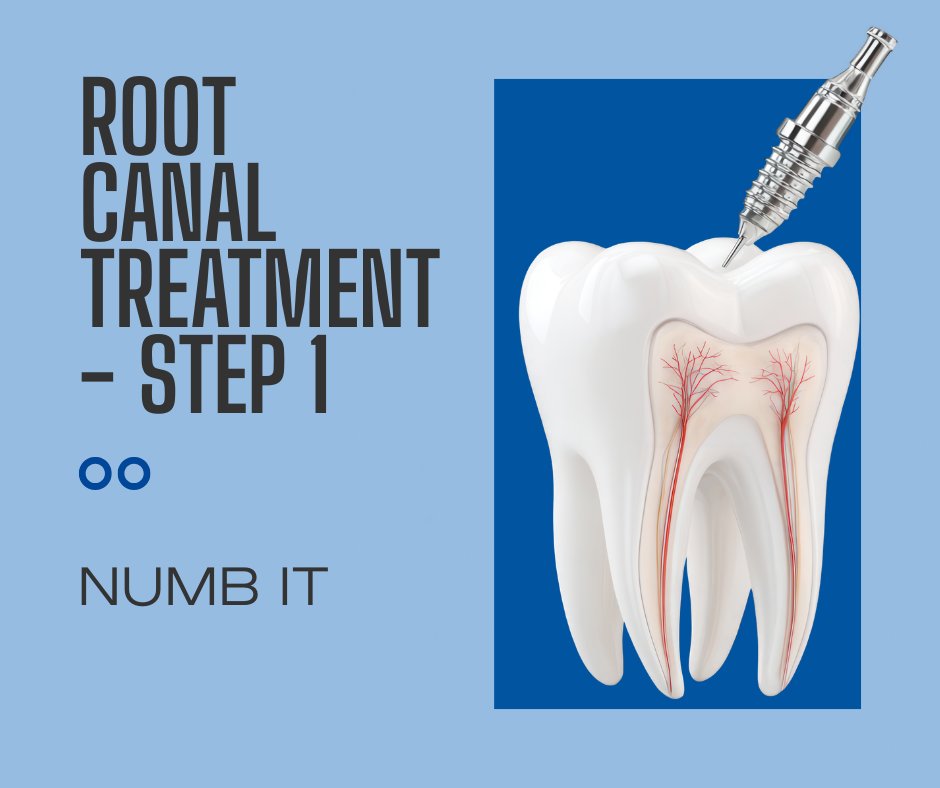 kent_endo's tweet photo. Your dentist will first take an x-ray and then will use local anaesthesia to numb the area. To keep the area dry & free of saliva during treatment, your dentist will place a rubber dam around the tooth.
#KentEndo #Endo #RootCanal #Kent_Endo
https://t.co/vn4haFR33f https://t.co/IY2C7r6Uc3