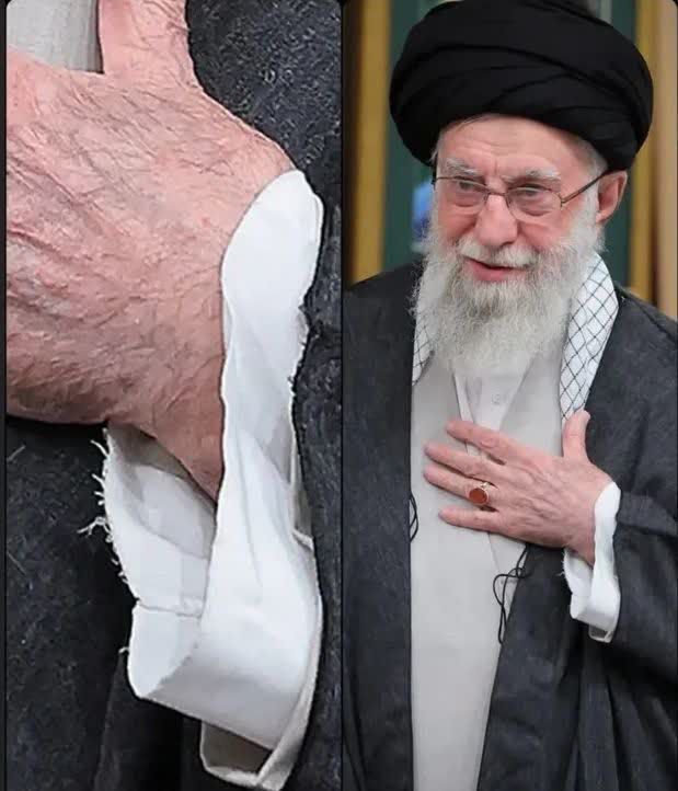masome34's tweet photo. ساده‌زیستیِ رهبرشهیدمون ، دیوارِ فروریفتنی از جنسِ «بی‌نیازی» بود؛ دیواری که هیچ تحریم و هیچ وسوسه‌ی مالی نمی‌توانست آن را بشکند. او با زندگیِ ساده، به ما آموخت که قدرت واقعی در "داشتن" نیست، بلکه در "بودن" است؛ بودنی که از جنسِ حق و صلابت است.

#کشور_دوست
#باید_برخاست https://t.co/pLTZWD0sM1