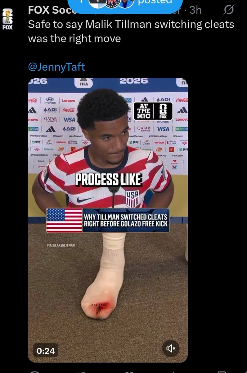 JRRTolCoin's tweet photo. @JackPosobiec You obviously don't know Jack about the sport or how badly 3/4 inch metal spikes can feel ripping into a thin material boot.   

Try it and see if you squeal or not Jack. https://t.co/UzpZ6p1Arh