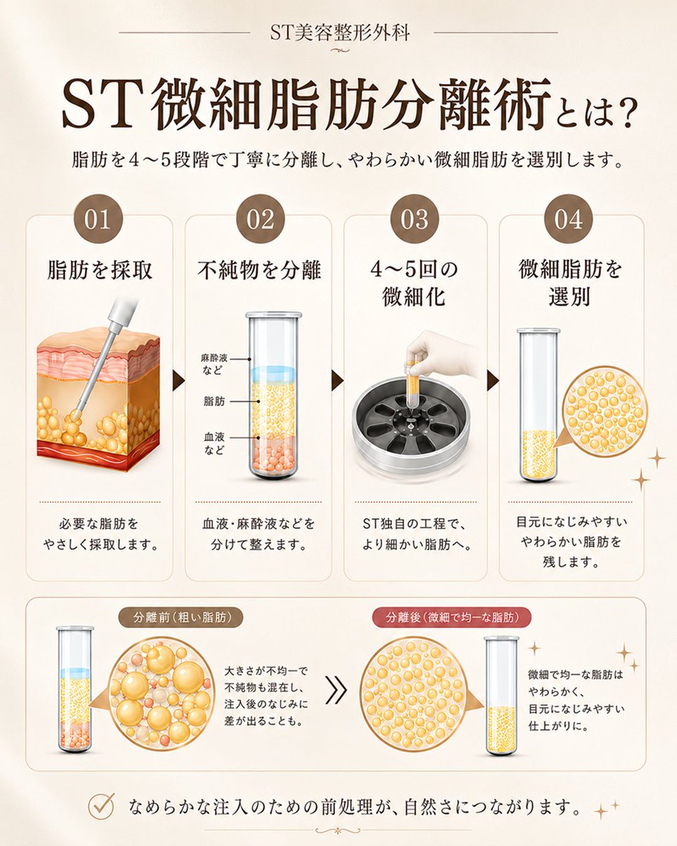 STPS_KOREA's tweet photo. 韓国で美容クリニックを選ぶとき、何を基準にしていますか？

ST美容整形外科についてお話しします🏥

韓国には数えきれないほどの美容クリニックがありますが
実際に足を運ぶとなると迷う方が多いはず。
SNSの口コミ、症例写真、立地…判断材料はさまざまですよね。

🔹 医師の経歴と専門分野
美容外科の専門医かどうかは
クリニック選びの基本中の基本。
ST美容整形外科では経験豊富な専門医が
一人ひとりの状態に合わせたプランを組み立てています。

🔹 カウンセリングの丁寧さ
施術の説明だけでなく、ダウンタイムやリスクまで
しっかり伝えてくれるかどうかも大切なポイント。
納得できるまで話を聞ける環境があるかは
信頼の目安になります。

日本語対応のスタッフが常駐しているので
言葉の壁を感じずに相談できるのも安心材料のひとつ✨

🏥 ST美容整形外科

みなさんがクリニックを選ぶとき、一番重視しているのはどこですか？
