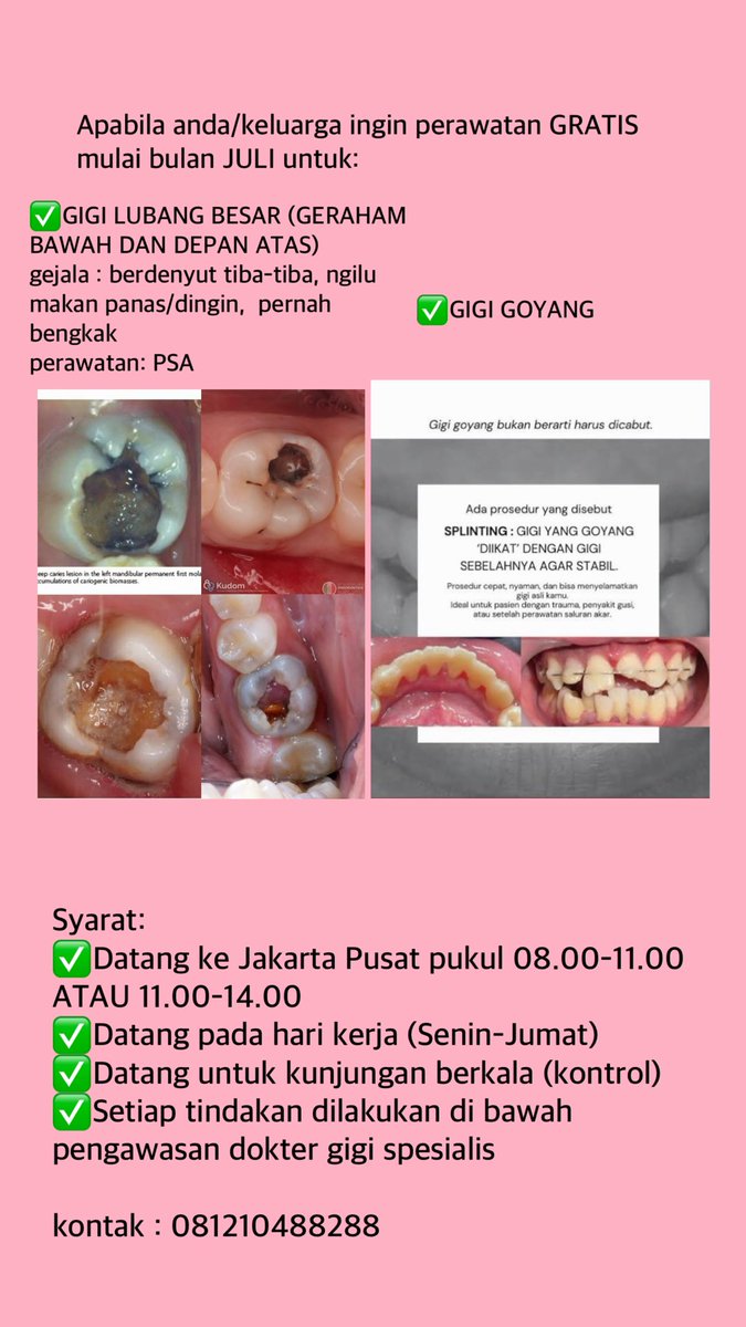 bratzdentz's tweet photo. Halo aku dokter gigi muda (koas) FKG lagi cari pasien GIGI GOYANG DAN GIGI BERLUBANG BESAR (GERAHAM BAWAH DAN DEPAN ATAS) MAU DI PSA perawatan gigi GRATIS di RS Jakarta Pusat. Berikut sayaratnya👇

Kontak :
☎️WA : 08121048828 

#sakitgigi #koasgigi #gigilubang https://t.co/v7YH1Kf1A0