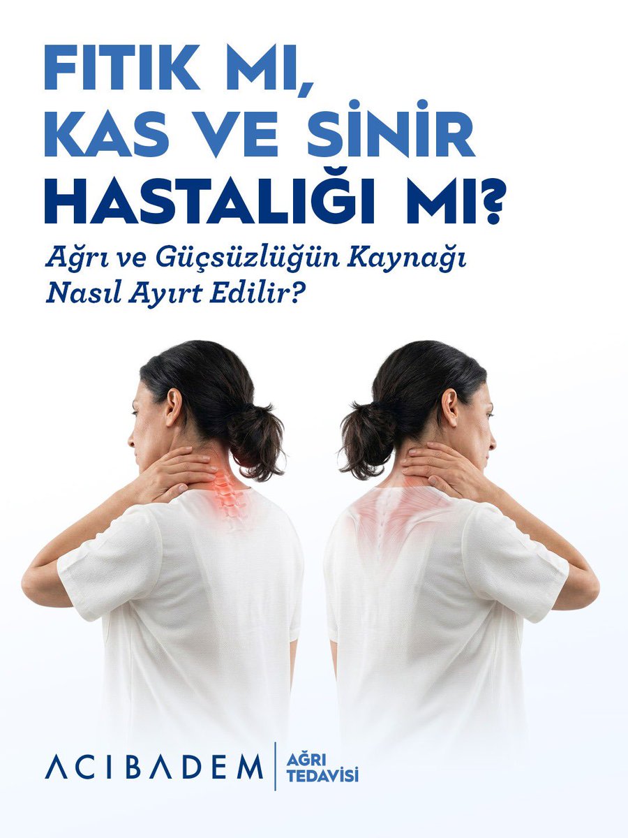 AcibademSaglik's tweet photo. Vücudunuzdaki ağrıların veya güçsüzlüğün nedeni bel ya da boyun fıtığı mı, yoksa kas ve sinir sistemini etkileyen farklı bir sağlık sorunu mu?

Uyuşma, karıncalanma, hareket kısıtlılığı ve kas güçsüzlüğü gibi belirtiler her iki durumda da görülebilir. Ancak ağrının yayılım şekli, eşlik eden bulgular ve günlük yaşama etkileri açısından önemli farklılıklar bulunur.
Benzer belirtiler gösterse de tanı ve tedavi yaklaşımları farklı olan bu iki durum arasındaki temel farkları öğrenmek için görselleri kaydırın. ➡️

Şikayetlerinizin nedeninin doğru şekilde belirlenmesi ve size uygun tedavi planının oluşturulabilmesi için bir uzmana başvurmayı ihmal etmeyin.

Fıtık tedavisinde yenilikçi yöntemlerle ilgili bilgi aşağıdaki linkte.
https://t.co/T8v27QZbf4