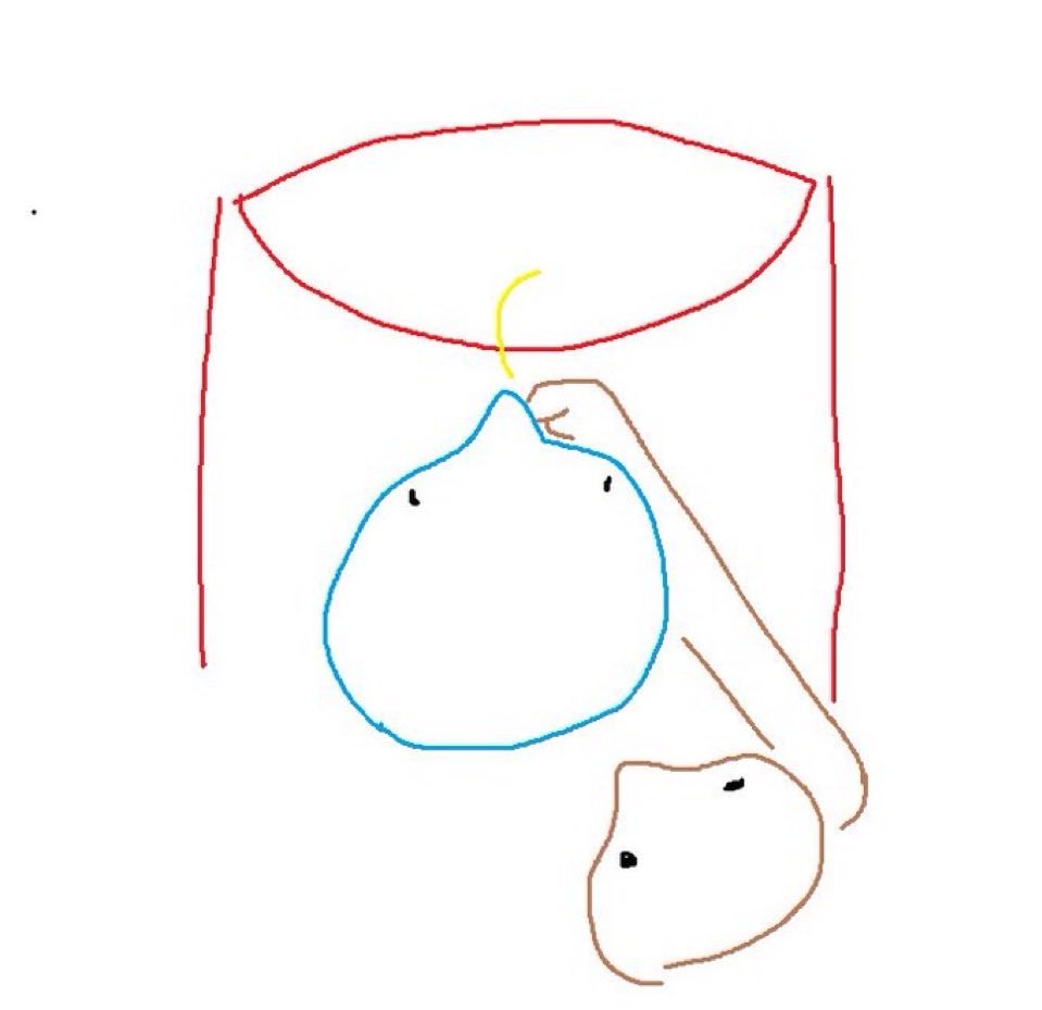 JokeURL's tweet photo. @SkinnyTuna https://t.co/QpquKfpLg1