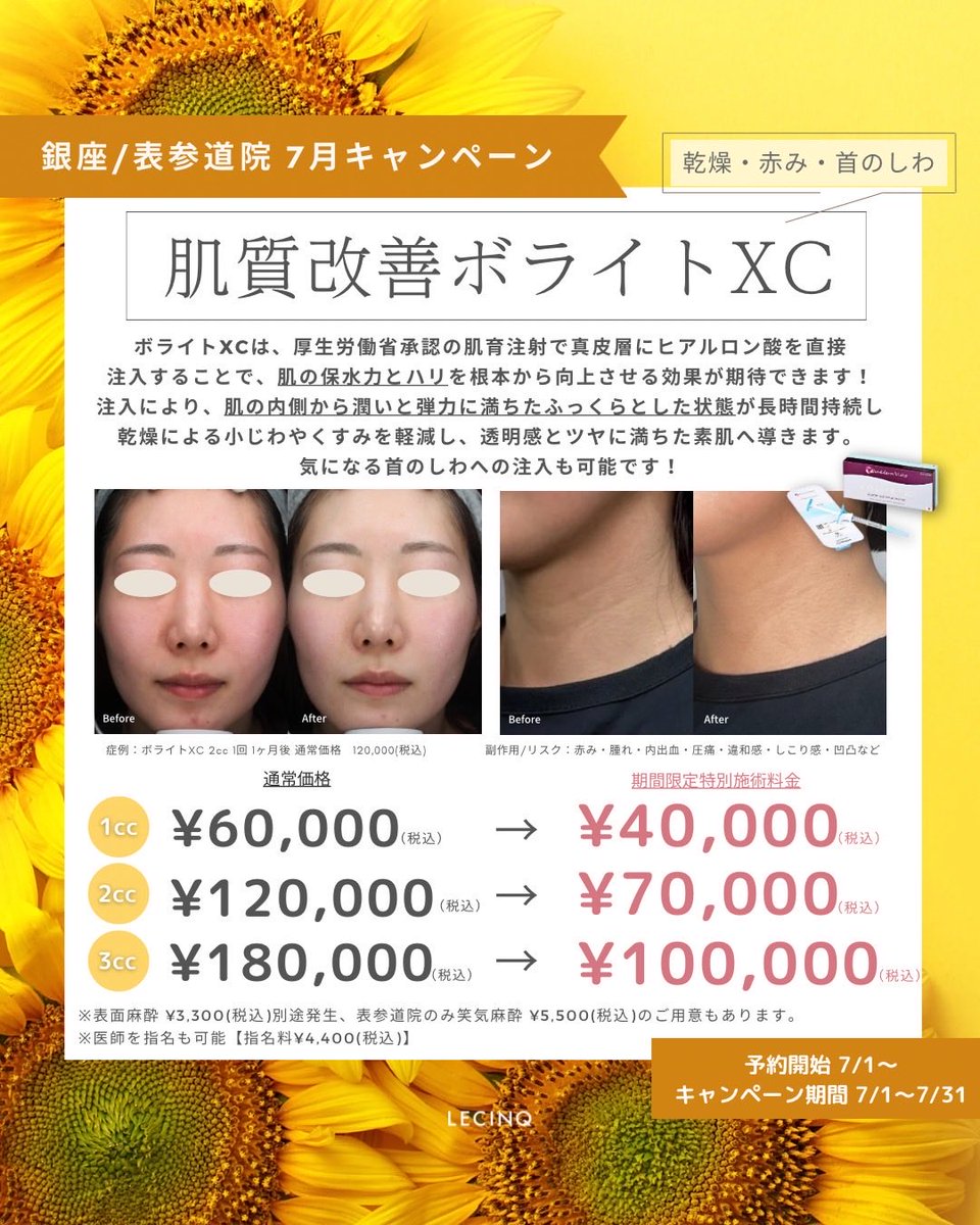 LecinqG's tweet photo. 7月のボライトのキャンペーンです。
ボライトで肌の土台を作ること���より、しみ治療が効率よく行うことができます。
また、コラーゲンを生成することでくすみの改善にも繋がります。
夏に土台を整えて秋からしっかりレーザー治療するのをお勧めします。 https://t.co/xg0jLBqrnF