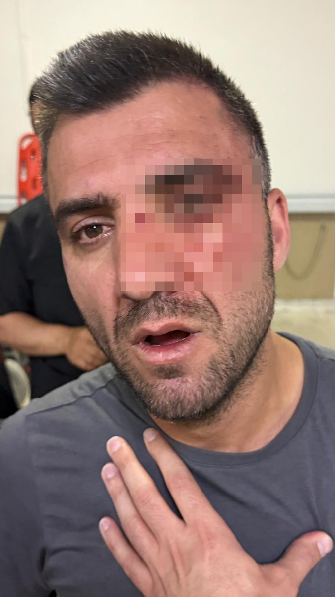 ozsagliksen's tweet photo. BİR ÜYEMİZ DAHA SAĞLIKTA ŞİDDETİN HEDEFİ OLDU

SBÜ Van Eğitim ve Araştırma Hastanesi’nde Veri Giriş ve Hazırlık Personeli olarak görev yapan üyemiz Oktay Özbey’in, hasta ve hasta yakınları tarafından darp edildiğini büyük bir üzüntü ve öfkeyle öğrenmiş bulunuyoruz.

Tamamen iyi niyetle, hastaya yardımcı olmak istediği esnada saldırıya uğrayan üyemize yapılan bu çirkin eylemi asla kabul etmiyoruz.

Her geçen gün bir yenisi eklenen ve artık tahammül sınırlarını aşan sağlıkta şiddet olaylarının bir an önce son bulmasını; faillerin en ağır şekilde cezalandırılmasını ve gerekli güvenlik tedbirlerinin acilen alınmasını talep ediyoruz.

Başta şiddete maruz kalan üyemiz Oktay Özbey olmak üzere, tüm Van teşkilatımıza ve sağlık camiamıza geçmiş olsun dileklerimizi iletiyoruz. 

Sağlıkta şiddete karşı mücadelemizi kararlılıkla sürdüreceğiz.