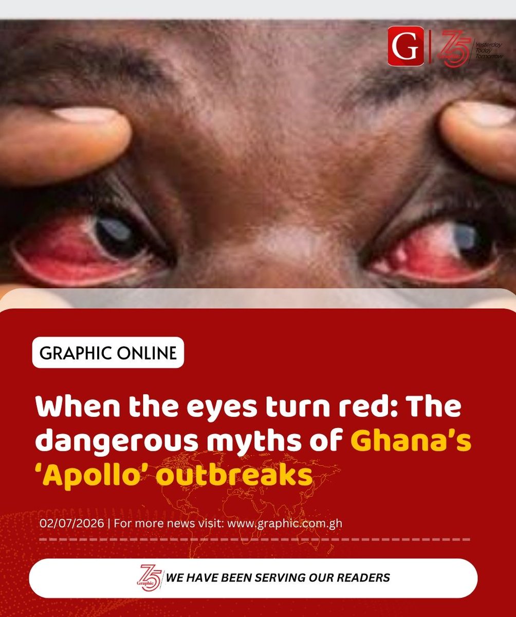 Graphicgh's tweet photo. It always starts the same way: waking up on a dusty morning with blood-red eyes that feel filled with sand and are glued shut with crust. In Ghana, this seasonal outbreak of "Apollo" triggers immediate social panic and a rush towards hazardous home remedies.

Read more in the comments section. 

#GraphicOnline