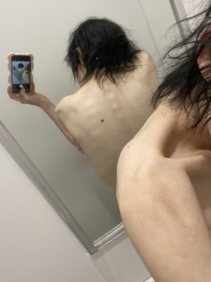 rotpilld's tweet photo. My back always itches #edtwt #ricecaketwt #thinspo #shedtwt https://t.co/4zh0LhdCy2