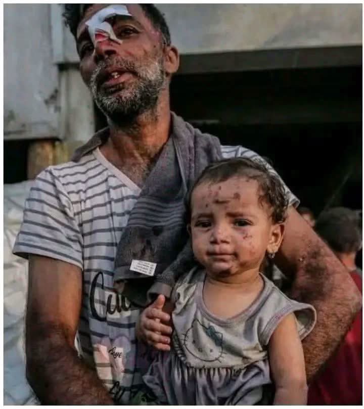 Emelia8z0's tweet photo. Gaze into the little girl’s eyes—a look far too mature for her years, heavy with unspoken questions about the cruelty enveloping her world. Then, look at her father; though a scar marks his forehead, the deepest wound is the one etched into his eyes as he watches his child endure this pain.
​At a moment like this, words fail to comfort us, and no phrases can capture the sheer weight of this grief and loss. All we can do is refuse to grow numb to such sight, and fight to ensure these living, beating hearts never fade into mere numbers on a news report.