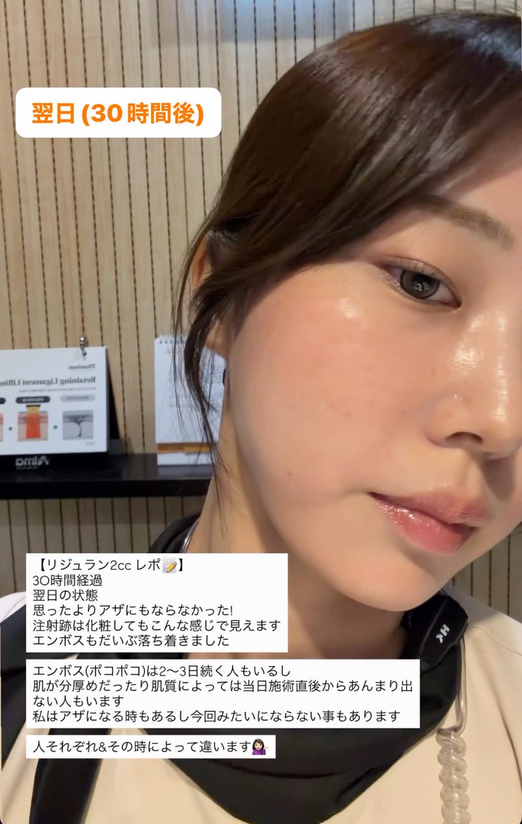 misa33lu's tweet photo. 職場のHP用の写真撮影で
リジュラン2ccだけした💉

リジュランは定期的にしてるけど
職場でするのは初めてで
エンボスが本当に綺麗すぎて感動した🥹✨
翌日も注射跡が少しあるくらいでアザにもならなかった
*あざはその時々によって個人差があります

担当医はクォン・ヒョナ院長
美人で優しくて丁寧で大好きな先生🧑🏻‍⚕️

2ccはほんと一部なので顔全体考えてる場合6ccは必要です🫡

🏥 @Pagelab_kr