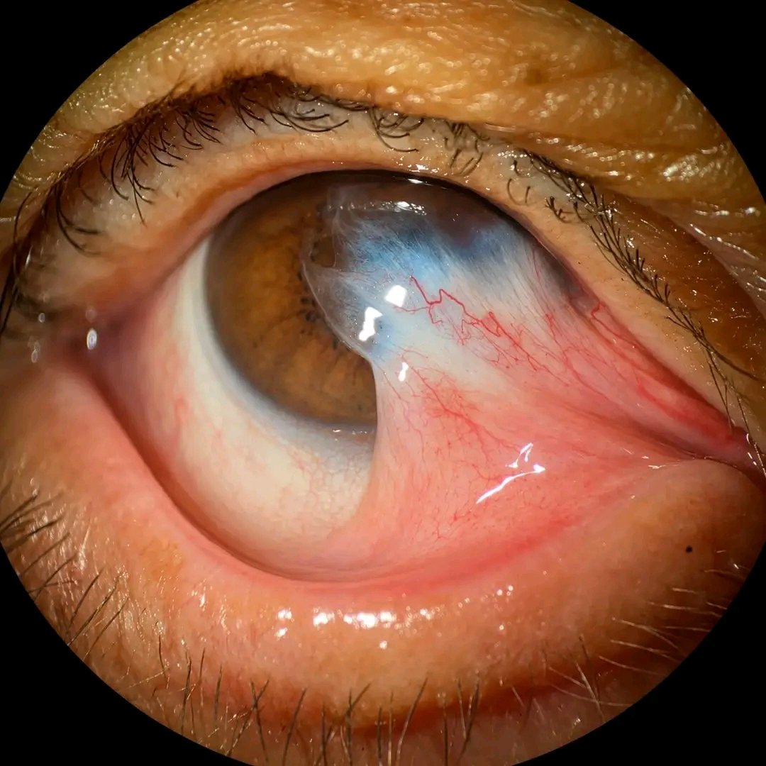 kh505043's tweet photo. Spot diagnosis...??!
. https://t.co/NquoQ2jAb0