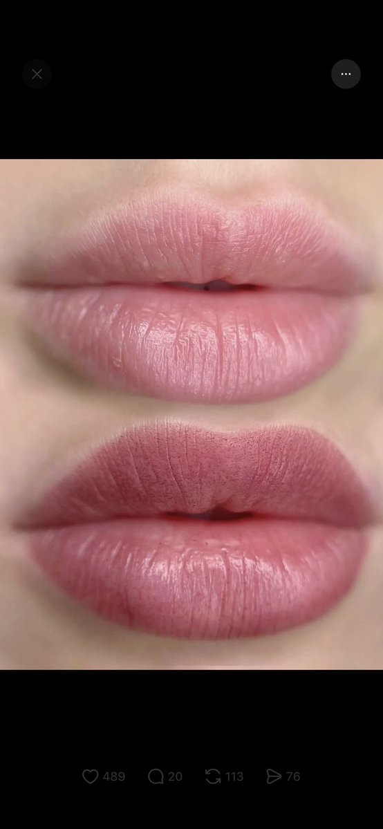venggk's tweet photo. Aku rutin pake ini tiap malem ya.. jd ini tuh exfo bibir gtu d aku ngaruh bgt 2 bulan jd pink https://t.co/afewtsIdZL