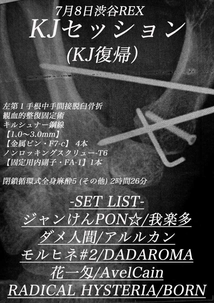 Kojism_'s tweet photo. 遅くなってすみません！

7/8 渋谷REXにて復帰します。

KJセッションよろしくお願いします

#片手使えません
#全治3ヶ月
#助けて
#FIFAWorldCup https://t.co/5RkGIvFUmT