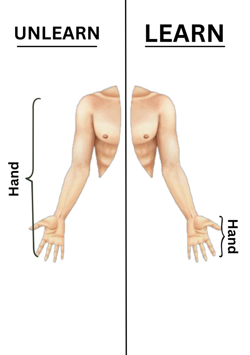 LasiloJohn's tweet photo. How long did it take you to get used to the fact that the entire upper limb isn't the hand, but that only the most distal part is actually called the hand? https://t.co/Hs0BIKqJ8B