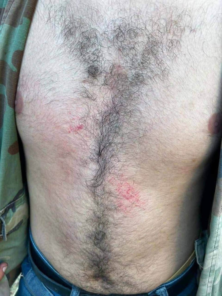 Duhok_Buzz's tweet photo. ⚠️ A group of Kurdish youths from Sheladize, northeast of Duhok, were reportedly detained and tortured by Turkish soldiers stationed on Kurejar Mountain in Kurdistan.

The youths had entered the mountain to forage for Kengirok, a traditional wild plant, to earn a living. https://t.co/uyO89zJ2Ze