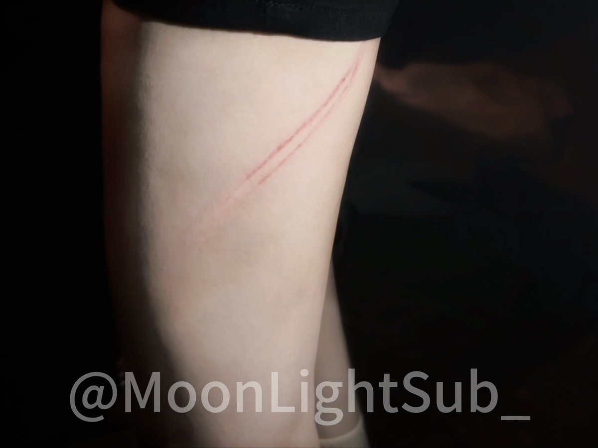 MoonLightSub_'s tweet photo. 痛痛痛😣
#小圈 #训诫 https://t.co/JVV9eMisns