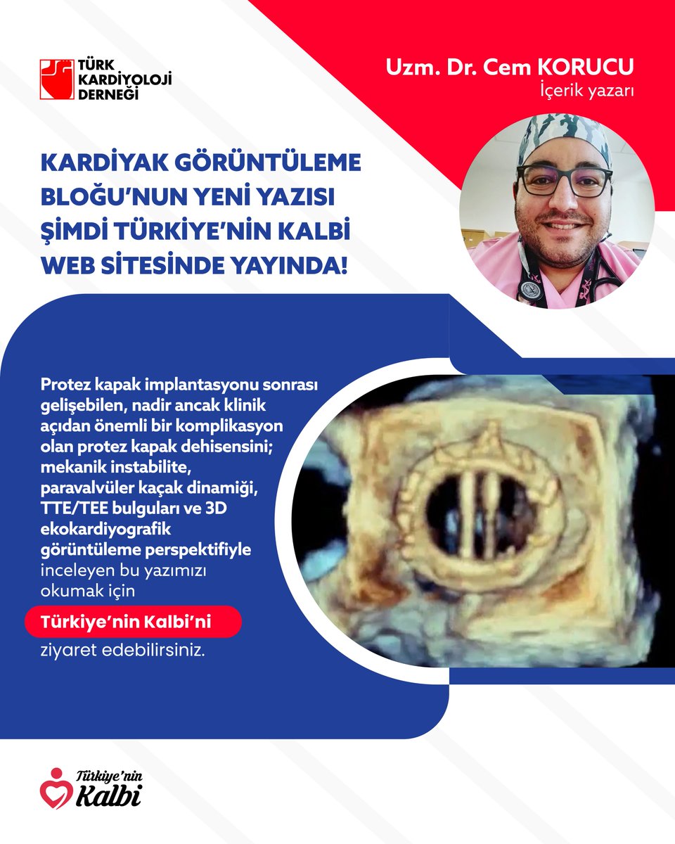 TKDResmi's tweet photo. Kardiyak Görüntüleme Blogu’nun yeni yazısı yayında!
Protez kapak dehisensini TTE/TEE bulguları, paravalvüler kaçak ve 3D ekokardiyografi perspektifiyle ele alan yazımızı Türkiye’nin Kalbi’nde okuyabilirsiniz.
https://t.co/AMZ1bv1jVo

#TürkKardiyolojiDerneği #TKD https://t.co/uFgAXKgzmp