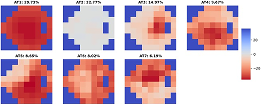 ARVOiovs's tweet photo. Piero Barboni et al. from Studio Oculistico d'Azeglio use machine learning algorithm archetypal analysis (AA) to characterize visual field (VF) loss patterns in patients with chronic Leber hereditary optic neuropathy (LHON).
https://t.co/9re4A1qL0A https://t.co/mCTbGjJRsu