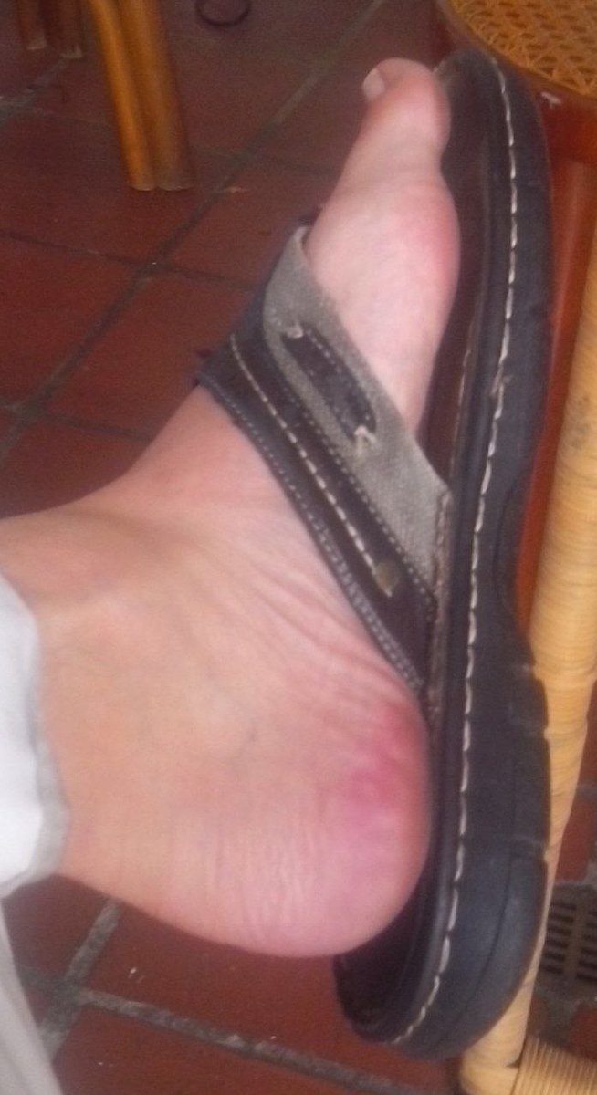 feetmodel156's tweet photo. Another kind of #sandals. #model #modeling #shoes #sandals #heels #highheels #footwear #foot #feet #barefeet #feetmodels #feetjob #feetnails #solesfeet #solesandtoes #soles #arches #archesfeet #archesandsoles #feetarches #toes #toenails #toenailspolish #toenails https://t.co/5VQnzzXg5g