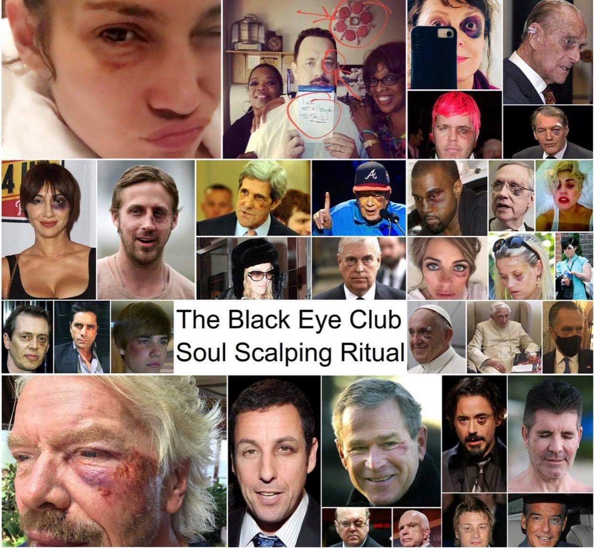Humanbydesign3's tweet photo. #SalvadorDali&amp;Vril Reptilian. In caseUdon’t know what these creatures Rabout,the celebrities in the pictures below have a black eye due2a procedure of droning these miniature type of reptilian parasite is inserted int2the eye &amp;in the course of 2 weeks,takes control over the host https://t.co/iPnlWie5Wi