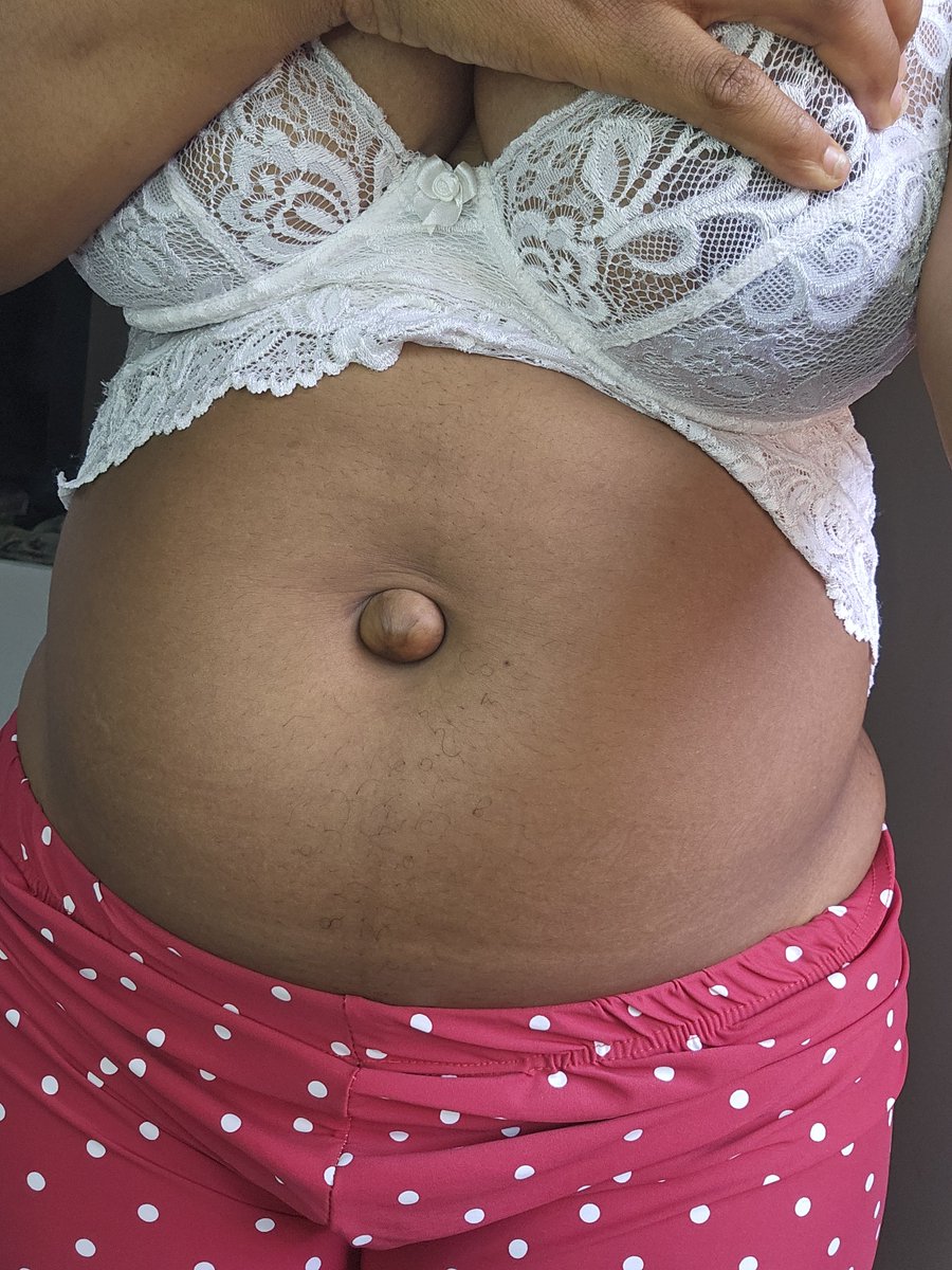 Biancaqnwg's tweet photo. #outie 
#bellybutton
#outiebellybutton 
#navel https://t.co/6WpmN7VuQd