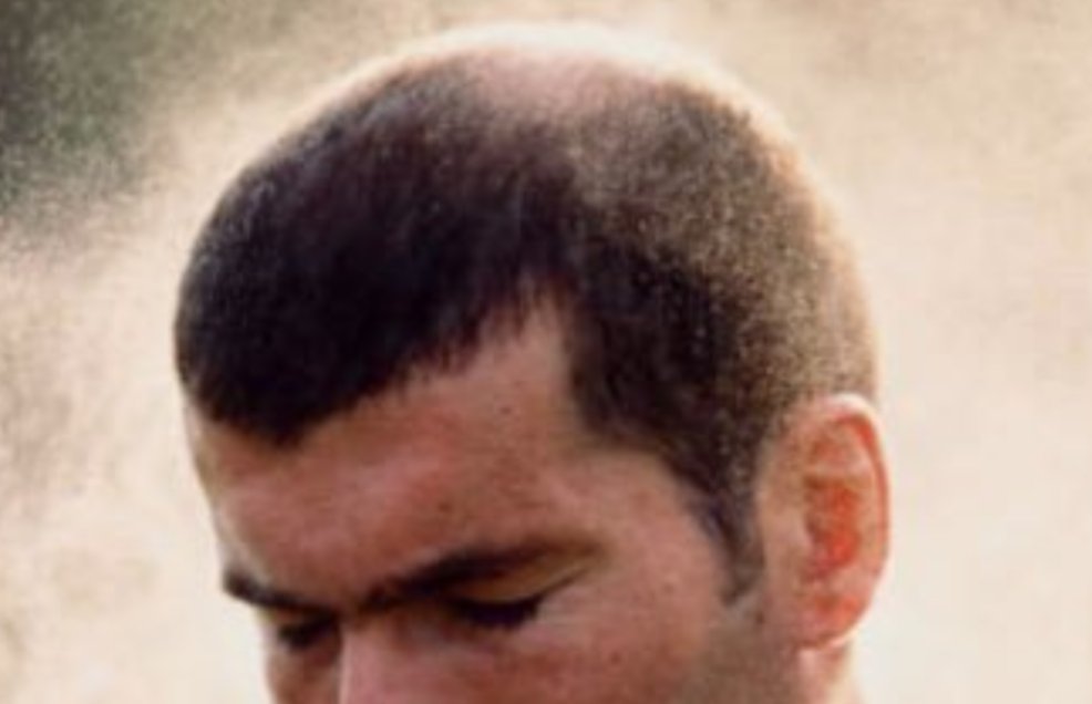 DonMastropiero's tweet photo. @PrimeZZidane5 @Opositorsv @el_triqui_ Seguramente acabaste con una cabellera igualita a la de Zizou, cretinazo 😂😂😂😂
Supera tus complejos, y como Zidanea acepta tu calvicie 👴🏾 https://t.co/xRPydPFvo1
