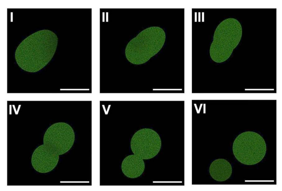 SynBioBeta's tweet photo. What if you could build a living cell from scratch, part by part, with nothing hidden inside?

@KateAdamala's team just did exactly that, and it may change how we engineer biology.

For decades, cells have been black boxes. In E. coli, the most studied organism on Earth, a third of its genes still have no confirmed function. You cannot reliably engineer what you do not understand.

SpudCell flips that problem. It is a minimal synthetic cell built entirely from defined parts, and every component is known and placed on purpose. It expresses proteins, grows by fusing with feeder liposomes, divides without a cytoskeleton, and even undergoes Darwinian selection. In one experiment a mutated version outcompeted the standard cell within five generations.

The team is careful with the language. They call it "constructed rather than created." This is a first prototype, not artificial life, but it is fully defined, and that is the whole point.

The bigger vision is a biology engineered the way computers are, in modular layers that anyone can build on. Alongside the work, Adamala and her co-founders launched @Bioticorg, a nonprofit to keep the chassis open so progress across labs finally adds up.

Visit the #SynBioBeta website to read the full article:
https://t.co/F5smzzcRXF
