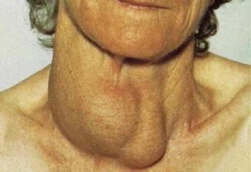 Bonxkk's tweet photo. @MasterBolaji Take his weak balls from your throat...you will choke https://t.co/gDjFIixC0O