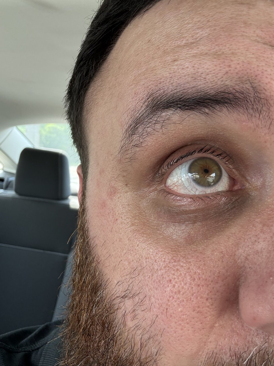 kmathisen's tweet photo. @susravioli Just for that, now you have to look at my eyeball too https://t.co/p4r0wQEwjB