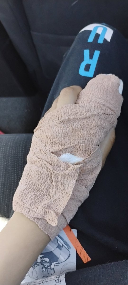 snow_crow1's tweet photo. I haven't been on in a while sorry for that I didn't mean to go offline that long but I was going to post again but I got injured 2 weeks ago and then last week they did surgery on my finger and I went on another break but I'm back https://t.co/uV1sOzIRt4