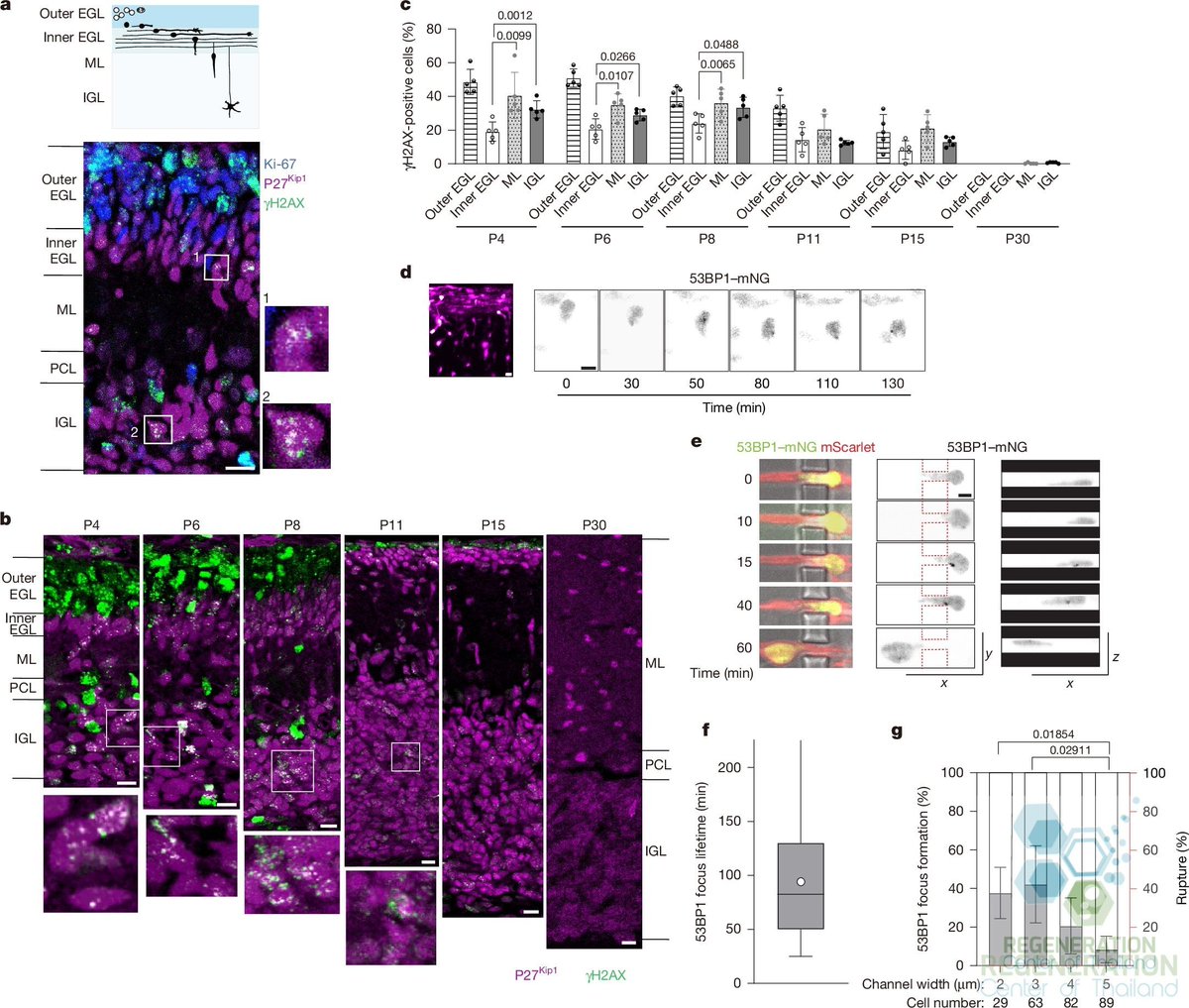stemcellscenter's tweet photo. Building a Brain Requires Neurons to Break and Repair Their DNA

https://t.co/0w7zp9zjjv https://t.co/WXRhasf0jR