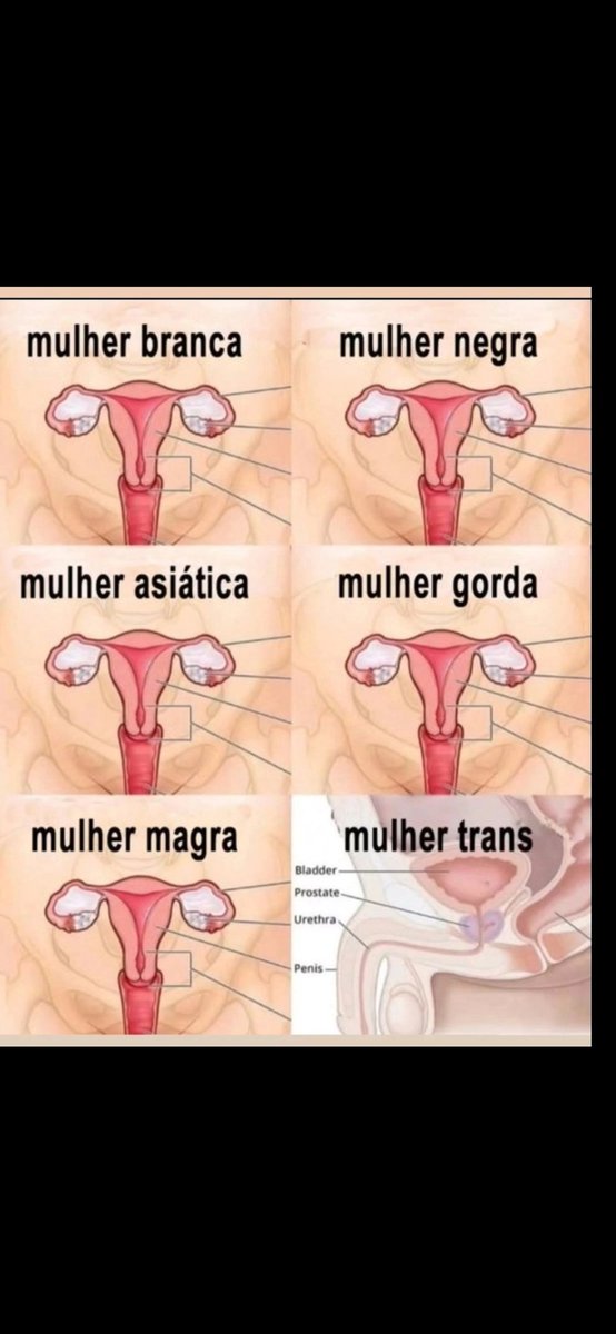 mauriciotzel1's tweet photo. @TumultoBR #MalditosVermelhos https://t.co/MUkyxMI4RO