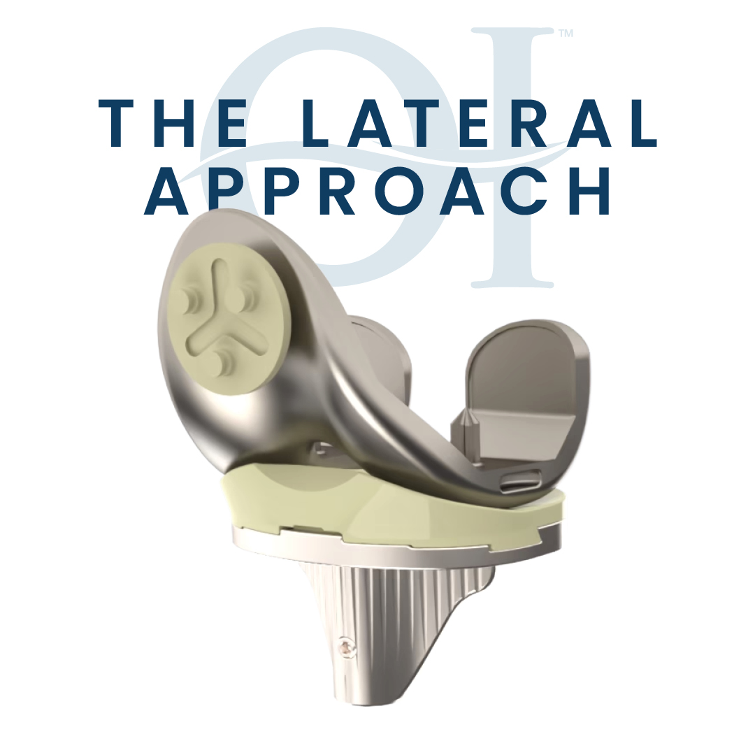 optimotionknee's tweet photo. Innovation is in the details.

Our implant systems are engineered for precision, stability, &amp; OR efficiency, empowering surgeons to deliver the best possible patient outcomes.

Discover our tech: https://t.co/cI6zxM8Odn
#OptimotionImplants #Orthopedics #MedTech #JointReplacement https://t.co/T7qRlMJiid