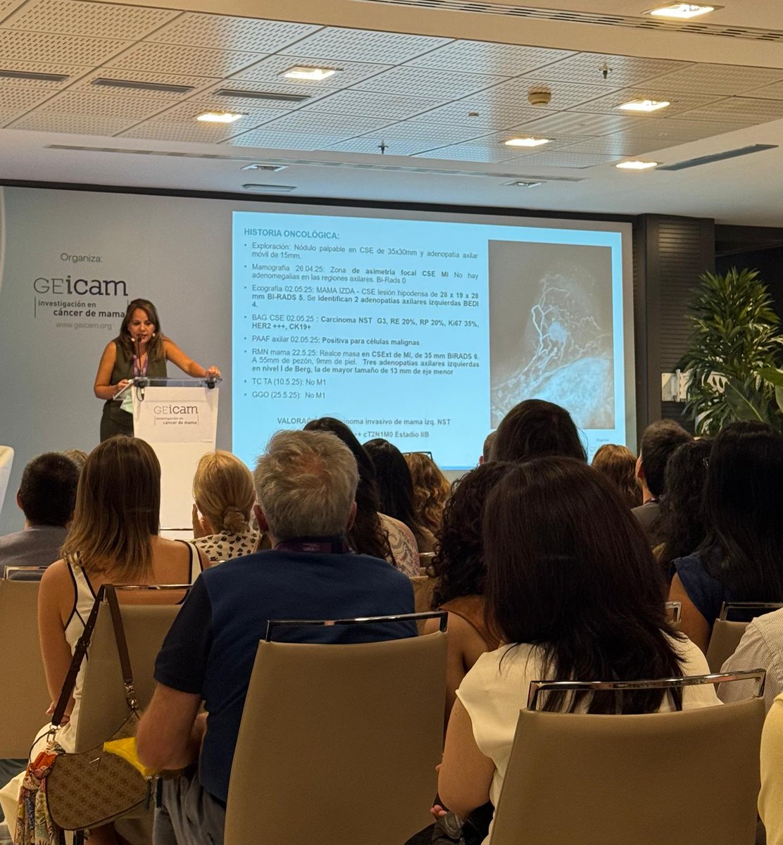 GEICAM's tweet photo. 📡 ¡Todos en la misma onda! Comienza la sesión de Comité de #RADARGEICAM, moderada por la Dra. Silvia Antolín, del Complejo Hospitalario Universitario de La Coruña.

Con los doctores/as 👉 Alejandro Falcón, del Hospital Universitario Virgen del Rocío 🏥 @HospitalUVRocio; Evelyn Martínez, del ICO L´Hospitalet-Hospital Duran I Reynalds 🏥 @ICO_oncologia; y Carlos Fuster, de la Fundación IVO de Valencia 🏥

🔎 Especialistas en oncología médica, oncología radioterápica y cirugía analizando juntos dos casos clínicos:
🔹 Caso #luminal 🔬 presentado por la Dra. Laura de Paz, del Complejo Hospitalario Universitario de Ferrol
🔸 Caso #HER2 🔬 presentado por la Dra. Andrea Vethencourt, del ICO Barcelona

🟣 Dos casos clínicos, distintas perspectivas y un mismo objetivo: tomar la mejor decisión para cada paciente.