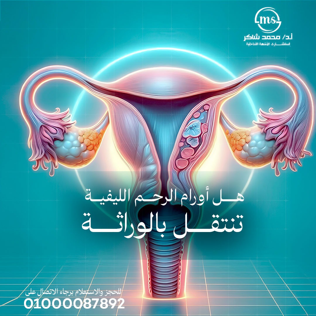 drMoShaker1's tweet photo. يدخل عامل الوراثة من ضمن العوامل المؤدية إلى الإصابة ب #أورام_الرحم_الليفية، فقد وُجد أنه تزداد نسبة الإصابة حوالي ٣ مرات عند المرأة التي لديها تاريخ عائلي للإصابة ب #ورم_الرحم_الليفي. 
ولكن هذا لا يعني بالضرورة أن كل سيدة لديها #أورام_رحم_ليفية أن ابنتها ستصاب. https://t.co/eP3x7rJOX8