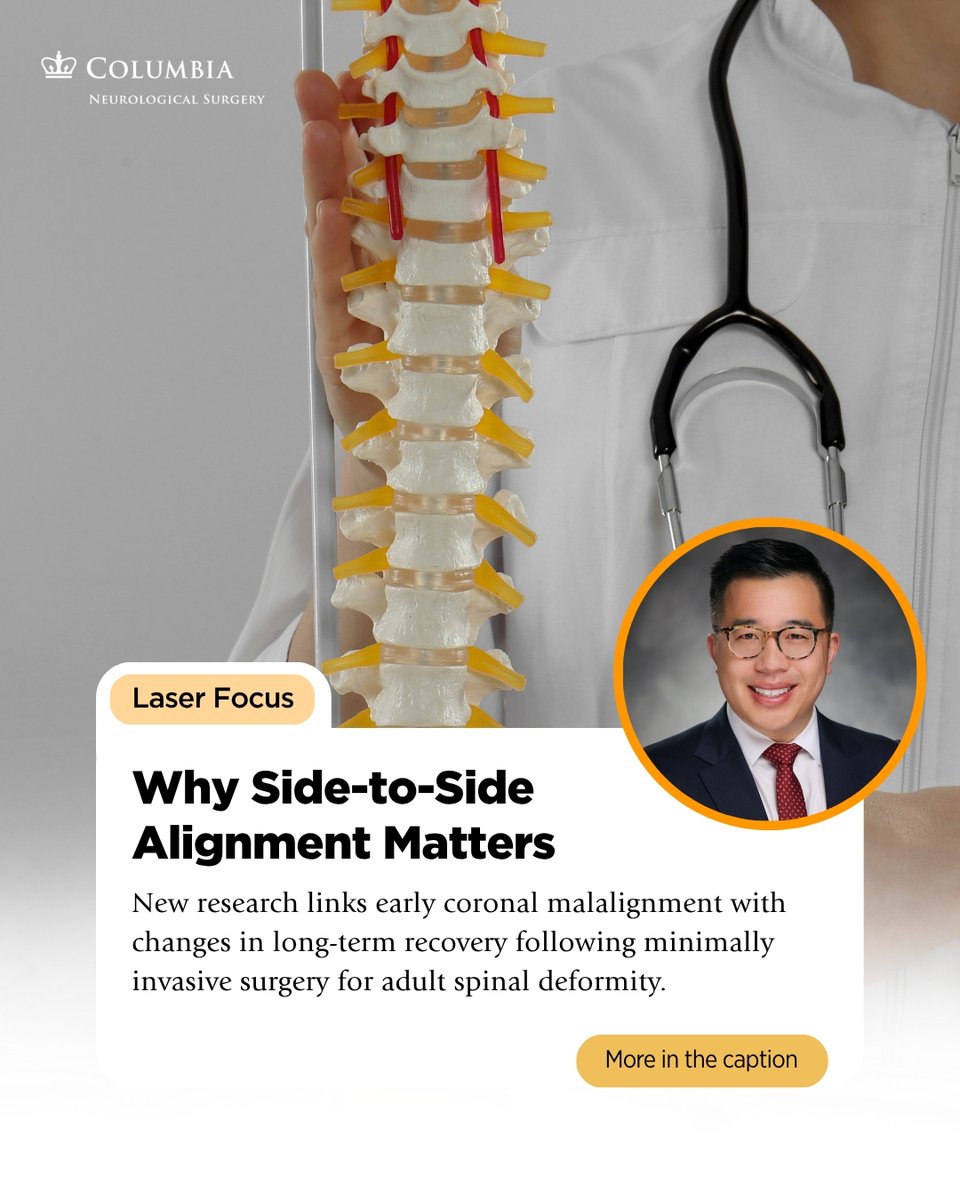 ColumbiaNeuro's tweet photo. New research in @SpinePhilaPA76 from @AndrewChanMD, @DeanChouMD et al found that residual coronal malalignment after minimally invasive surgery for adult spinal deformity was associated with delayed changes in functional outcomes.

Read the study below.
 https://t.co/JKDuEHXchr https://t.co/854YFlQIek