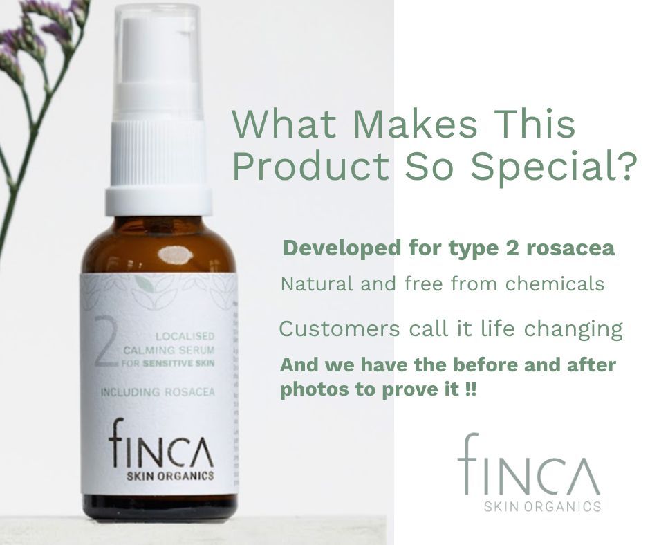 Finca_rosacea's tweet photo. great start to the day - a 5 star review with a repeat order..thankyou
#rosacea #rosaceaskincare #skinredness #rosaceaskin #rosaceacommunity #rosaceatreatment #calmskin https://t.co/2E6eMPZtjp