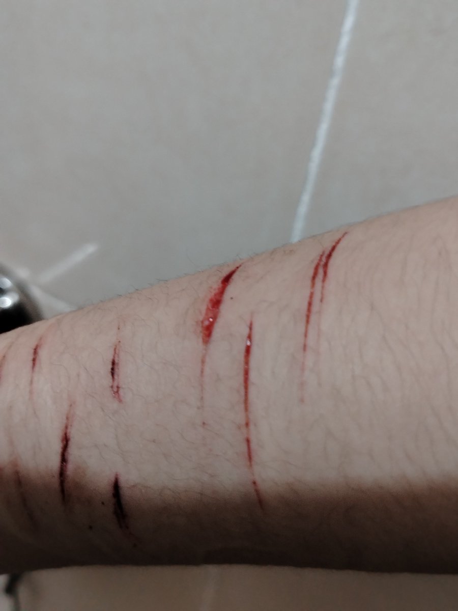 freezedriedmint's tweet photo. #shedtwt #shtwt FAKE AI GENEREATED SFX MAKEUP
.
.
idk if this is considered a deep styro or baby beand because this is the deepest i ever cut SEND HELP i already wrapped bandagrs around it :+( https://t.co/es9eS4xoWf