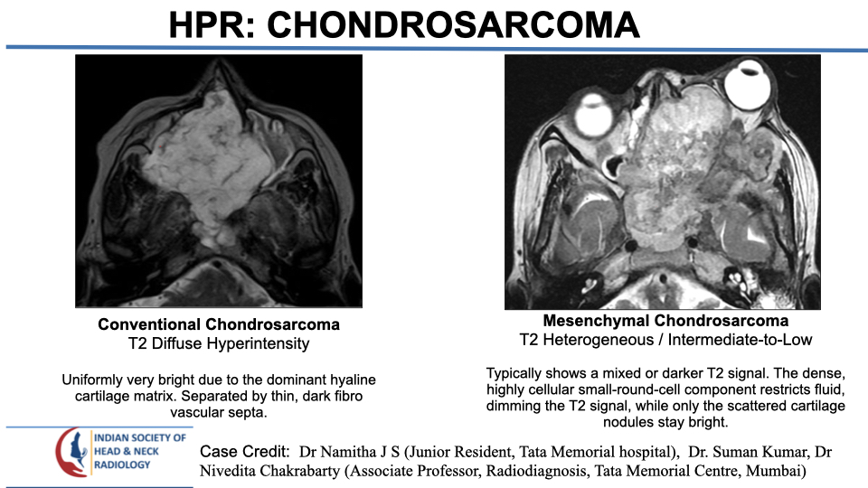 teamishnr's tweet photo. #caseoftheweekanswer

Please find the answer
#radiology #caseoftheweek #headandneck #radiologycases #dailywork #ISHNR #teaching #research #imaging #FOAM #FOAMRad #FOAMMed

Visit our website: https://t.co/4xzgh1IykC
All Cases: https://t.co/0xaPvoBy5H https://t.co/lmFboD8GbG