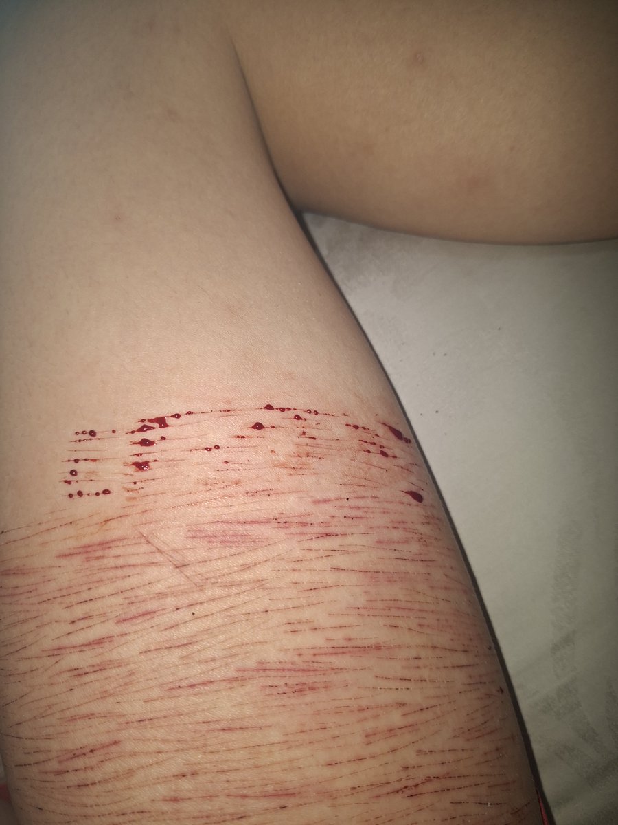 010Snsn's tweet photo. I need a new blade🫩 https://t.co/YALKBoMacv