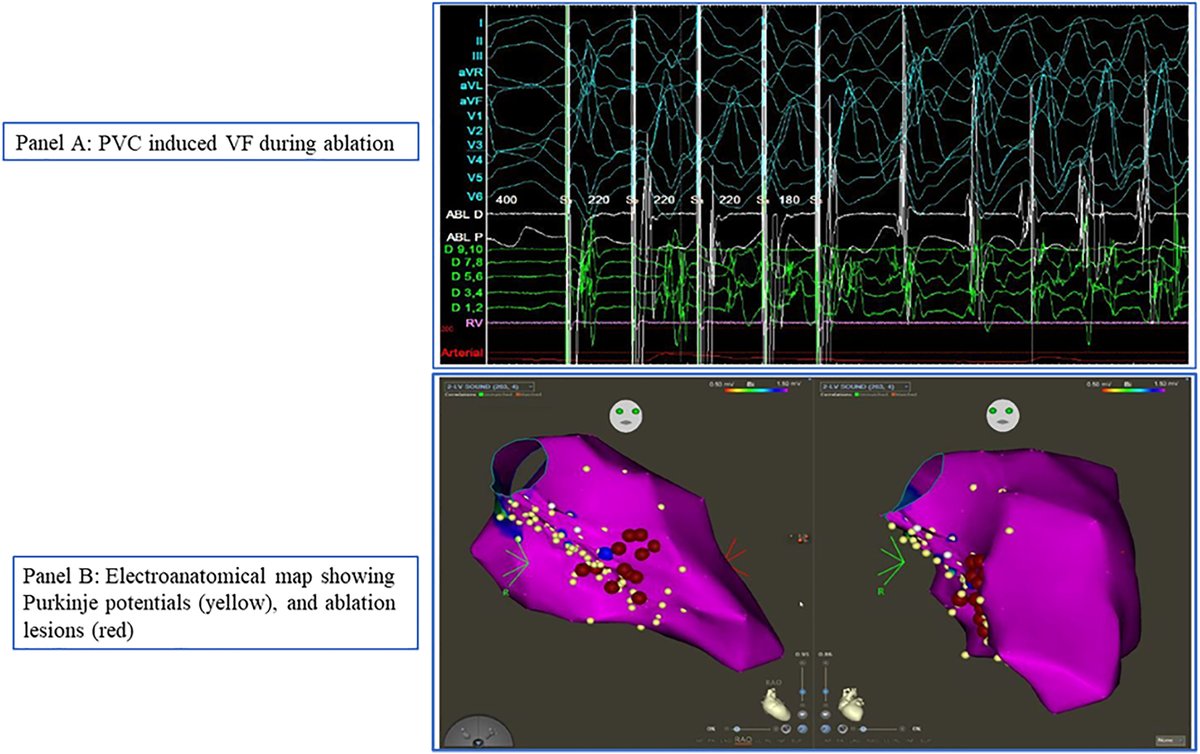 Heart Rhythm O2 tweet media