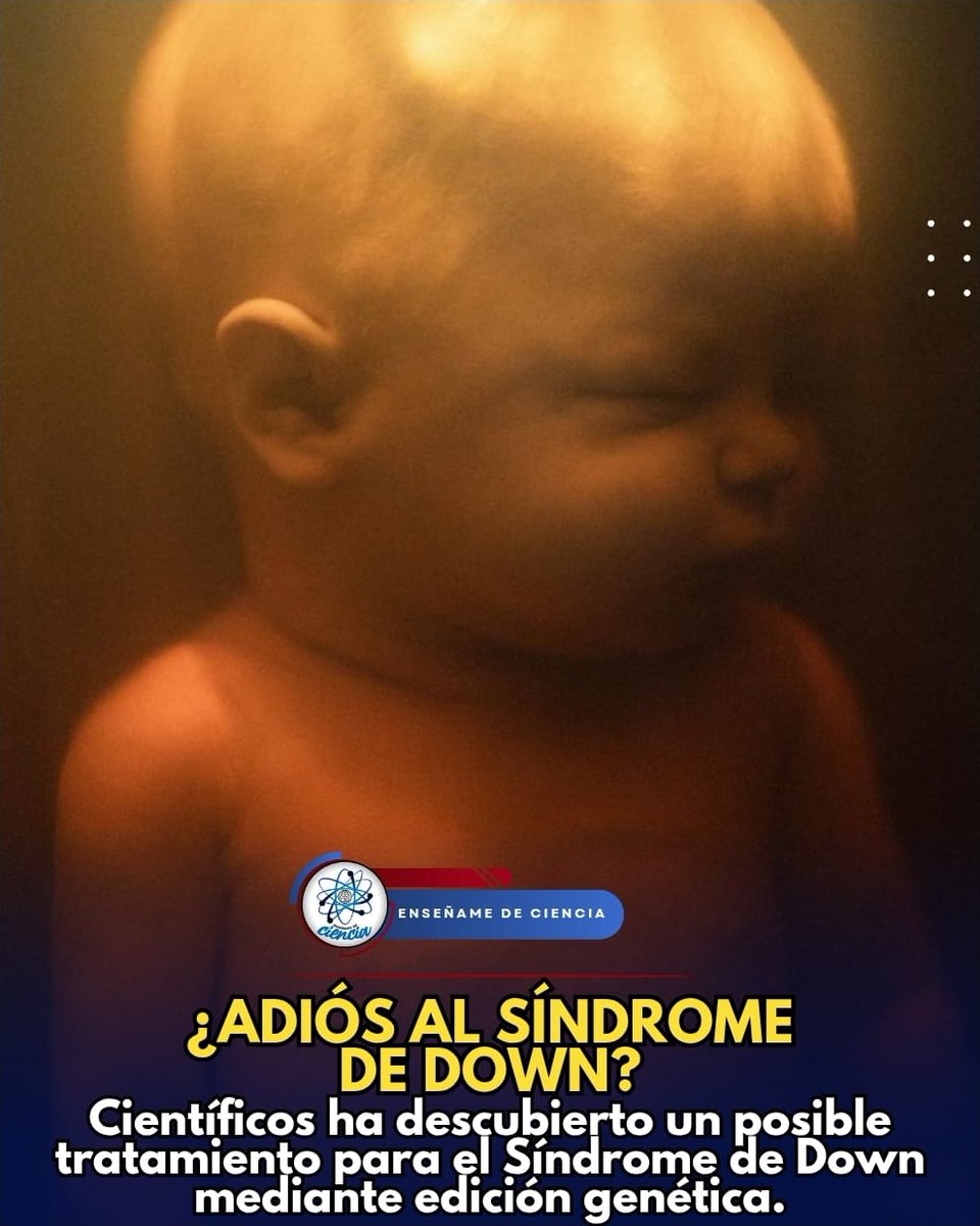 EnsedeCiencia's tweet photo. 🚨El Síndrome de Down es causado por la trisomía total o parcial del cromosoma 21. Lo que quiere decir que, en lugar de dos copias, hay tres. La frecuencia de esta trisomía es bastante elevada, con 1 caso cada 700 nacimientos. https://t.co/Ah6Gu0Wc8O