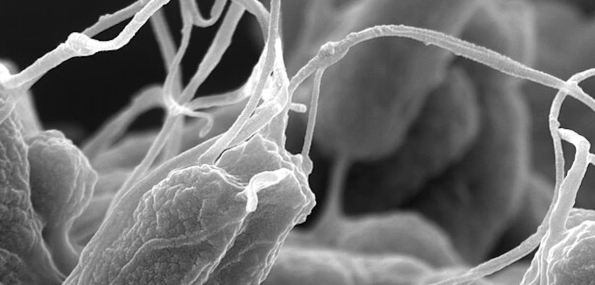CanHealthwatch's tweet photo. How generative AI and physics can help design new antibiotics.
By Rachael (Ré) A Mansbach and Jyler Menard. Find this article and more at https://t.co/iiTxKdhc1W #CanadaHealth #DigitalHealth https://t.co/bdDSddKQnB