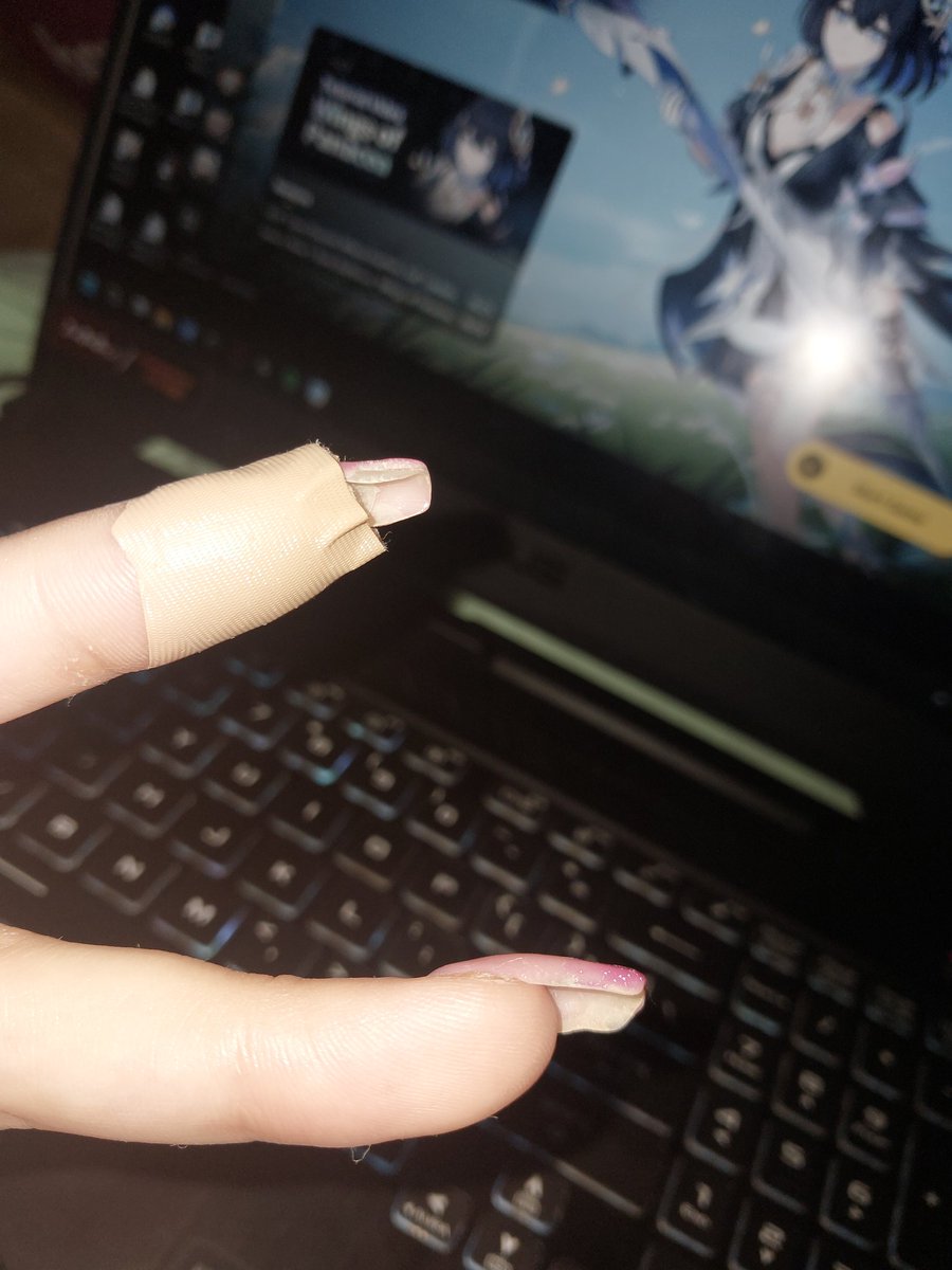 L4NDOFILES's tweet photo. getting new nails done tomorrow cause wtf is that https://t.co/33KmphMJWA