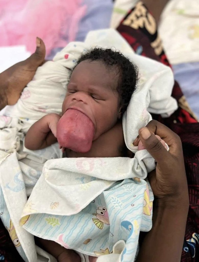 DemiDey4u's tweet photo. A cry for help😭

My new born baby is in critical condition and lots of pain😩 He’s in so much pain and urgently needs to go to hospital😭

He had some treatment but the Disease is still progressing🥹 Pls Don’t allow my son to die, he’s the only one i have💔🤲🏽

May God bless u🙏🏽 https://t.co/Vg53A0AENA