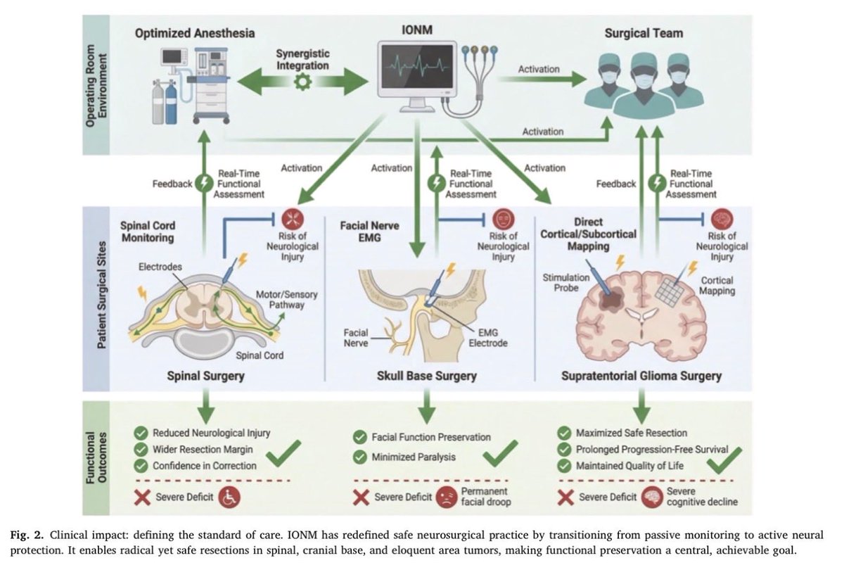 ICUAlgorithmLab's tweet photo. Intraoperative neurophysiological monitoring (IONM) has become the gold standard for high-risk neurosurgery, using multimodal monitoring (MEPs, SSEPs, EMG) and TIVA to safeguard patient function. 🧠🏥

✍️ By: Sun, Y. et al.
🔗 https://t.co/ba9o3DBWoB
#Neurosurgery #IONM #MedTech #AIinMedicine #Neuromonitoring