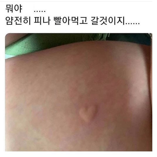 sattosi84's tweet photo. 모기가 나에게 플러팅을 했따 

아 이놈의 인기 https://t.co/nILD0Uc65u