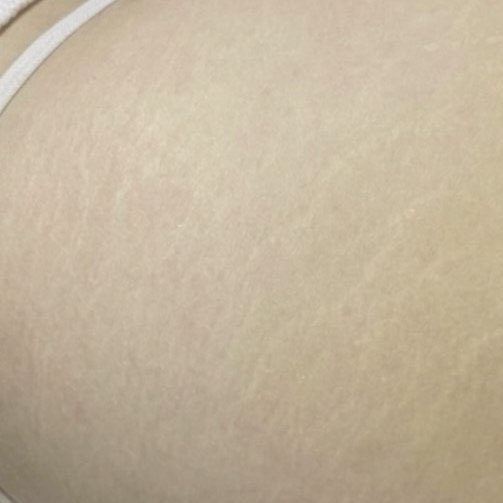 xurentpost's tweet photo. PANTESAN PRODUK INI DI JEPANG VIRAL, TERNYATA SEBAGUS ITU GUYS BUAT MUDARIN STRETCH MARKS 🥹💗 https://t.co/roykBuTi2M
