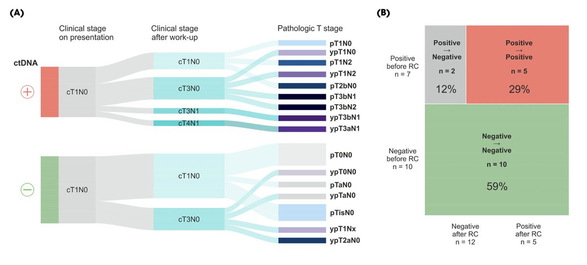 LauraBukavinaMD's tweet photo. 🧬Biology again outperforms staging ... Detectable ctDNA very accurately identifies pts harboring occult MIBC and N+ disease DESPITE  initial cT1N0 staging

In (v) high risk #NMIBC ( T1 + BCG exposed dz)
• 78% of ctDNA+ patients were pathologically upstaged at cx. vs 8% ctDNA-)
Time to incorporate into risk category?  @NateraGenetics  @BladderCancerUS @BJUIjournal   read more from our @CleClinicUro experience https://t.co/TSIlwdW5iE